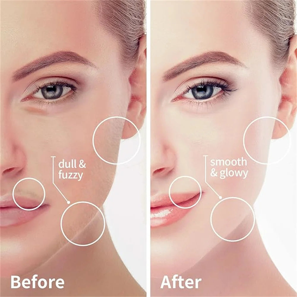 4-in-1 Facial Hair Remover for Women – Painless Electric Shaver & Epilator